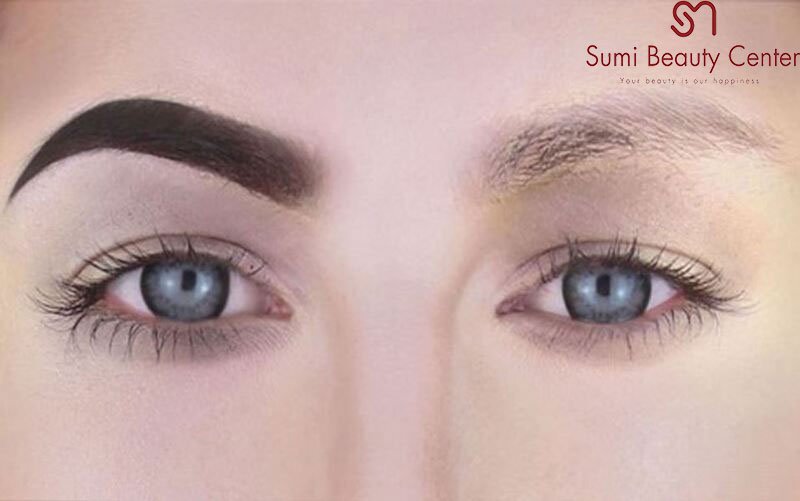 Hình ảnh sau khi xóa xăm bằng laser Hình ảnh sau khi xóa xăm bằng laser
