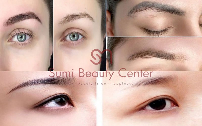 Hình ảnh trước và sau Hình ảnh trước và sau