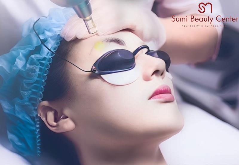 Xóa xăm chân mày bằng laser Xóa xăm chân mày bằng laser