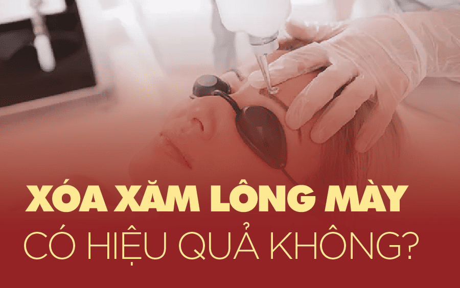 xóa xăm lông mày có hết không