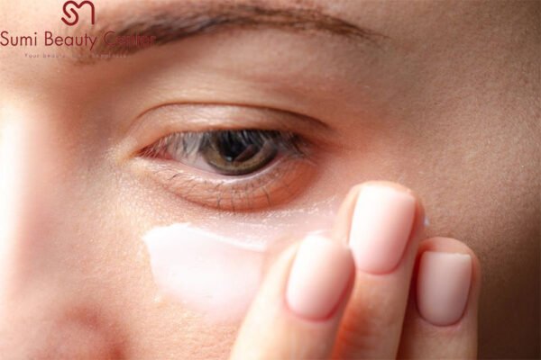 Cách chữa bọng mắt dưới từ tự nhiên không cần phẫu thuật