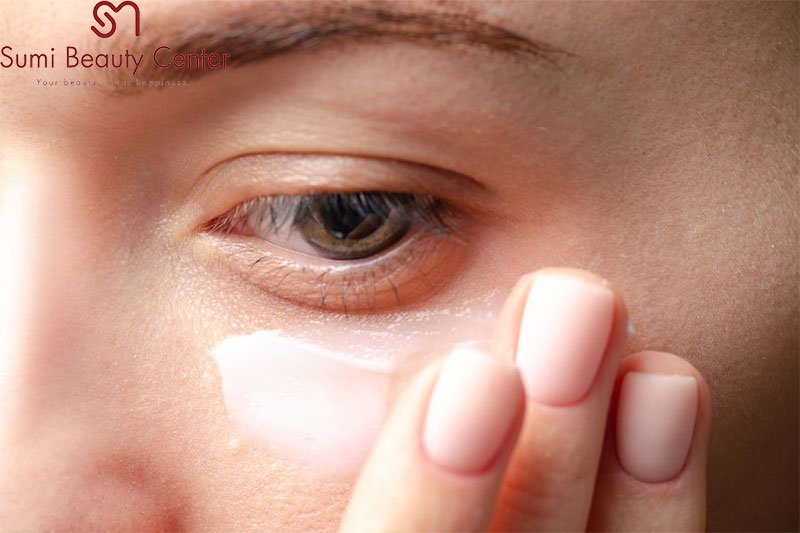 Cách chữa bọng mắt dưới từ tự nhiên không cần phẫu thuật Cách chữa bọng mắt dưới từ tự nhiên không cần phẫu thuật