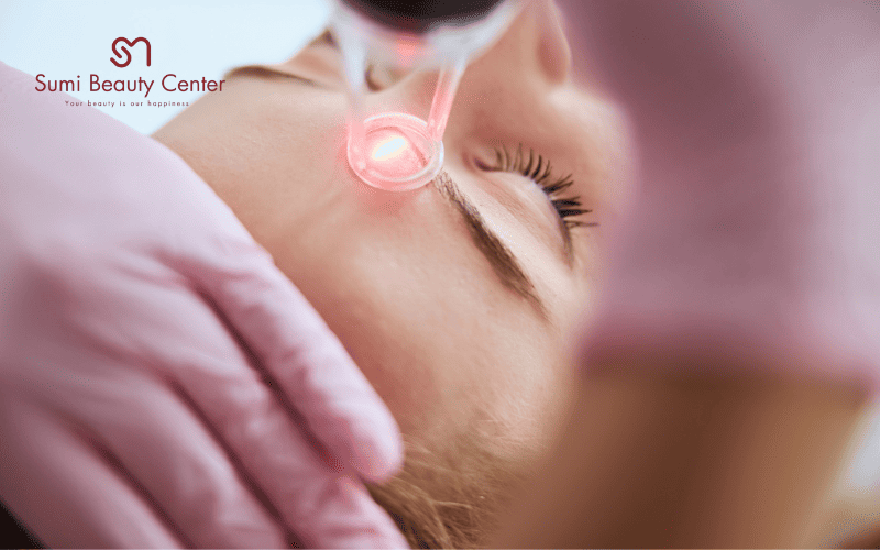 Kết quả sau điều trị