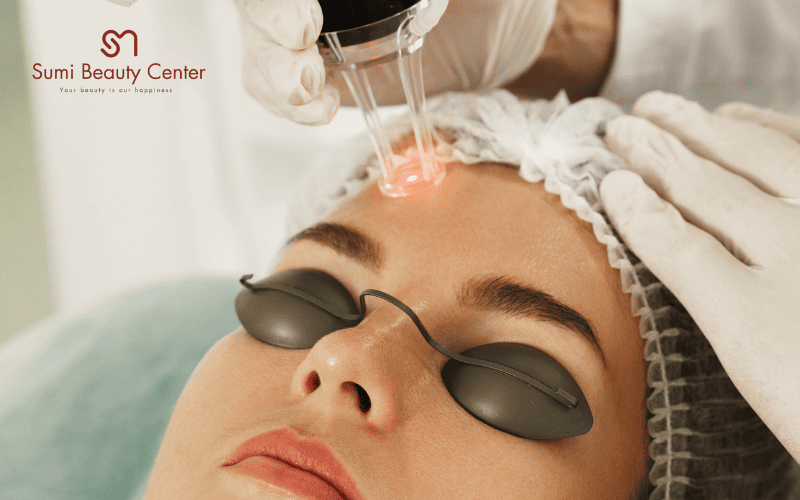 Ưu điểm của Laser trị bớt tại Sumi Beauty Center