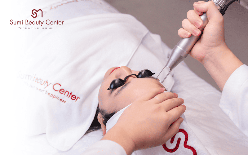 loại bỏ mụn thịt bằng công nghệ Laser 