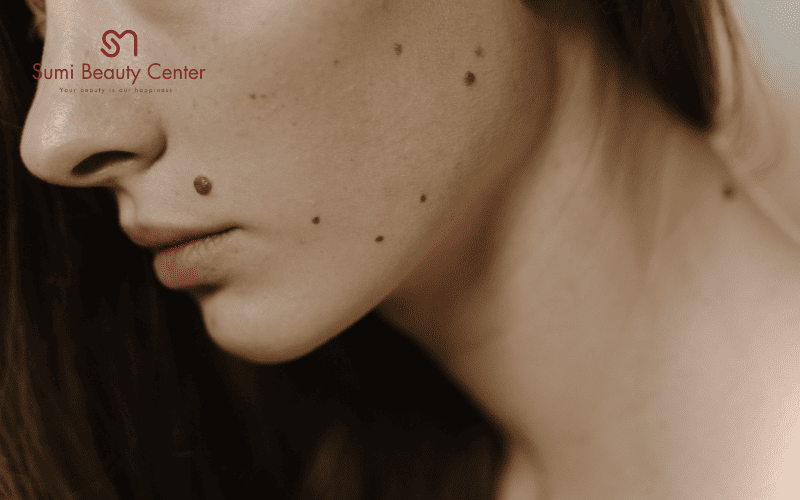 Quy trình điều trị tại Sumi Beauty Center