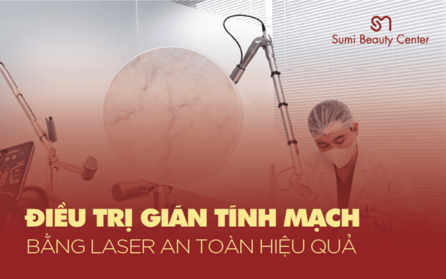ĐIỀU TRỊ GIÃN TĨNH MẠCH BẰNG LASER – AN TOÀN, HIỆU QUẢ