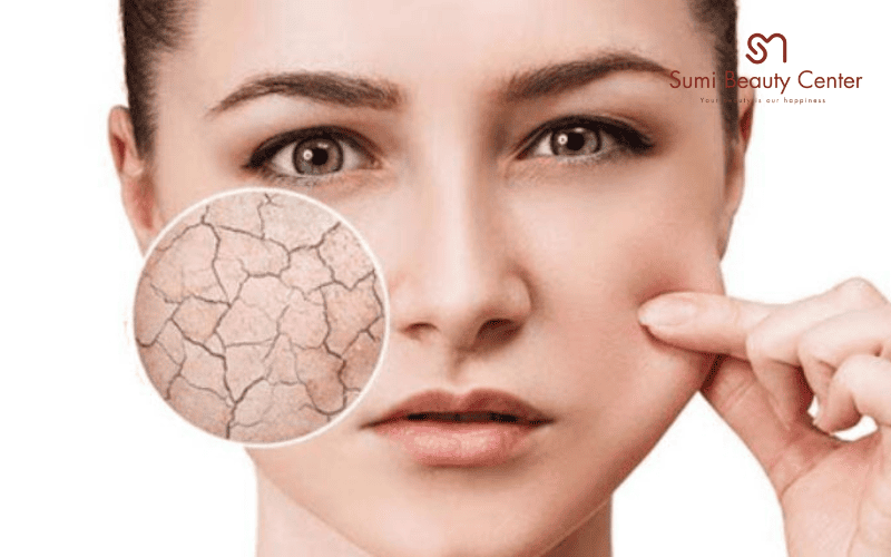 Không khí khô lạnh làm da mất nước nhanh