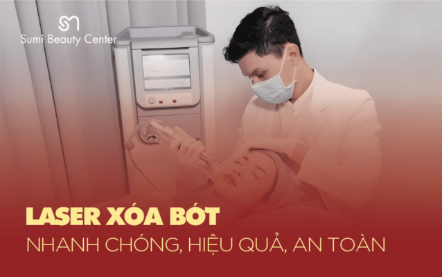 laser trị bớt
