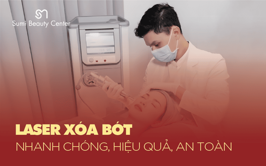 laser trị bớt