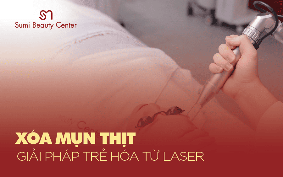 laser xóa mụn thịt