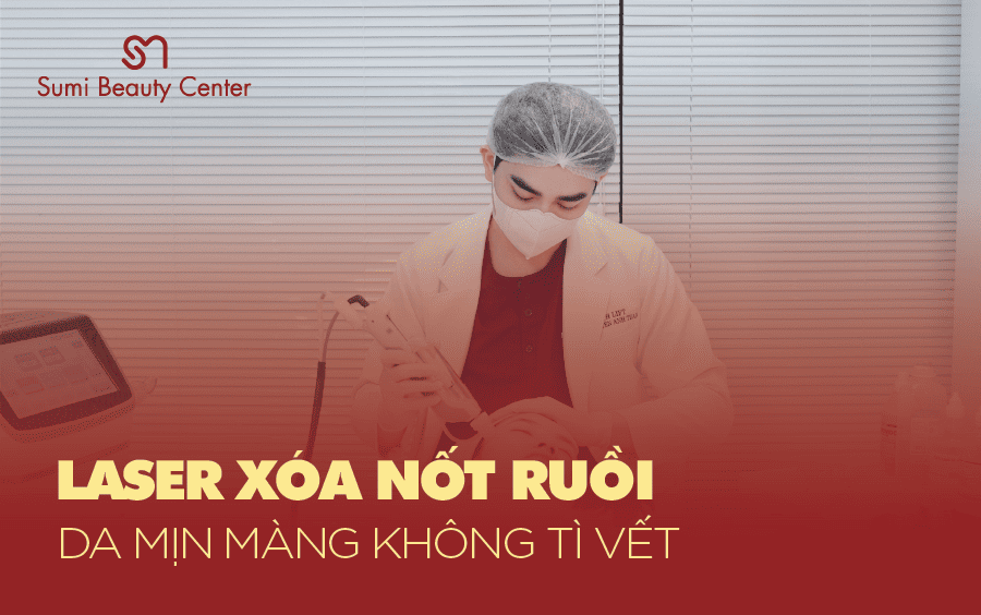 điều trị xóa nốt ruồi laser