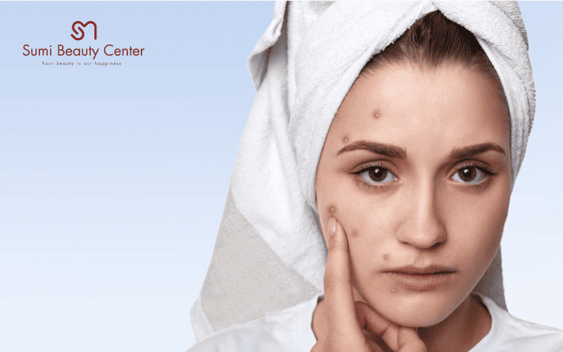 Những sai lầm thường gặp khi chăm sóc da mùa đông