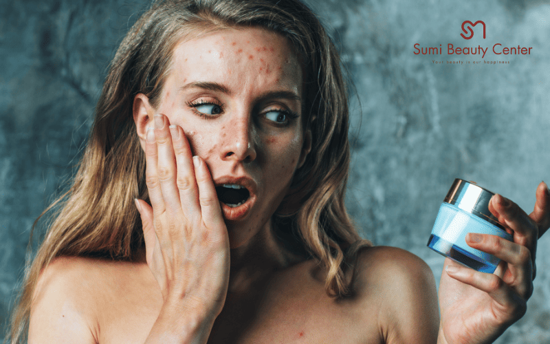 cách trị dị ứng mỹ phẩm