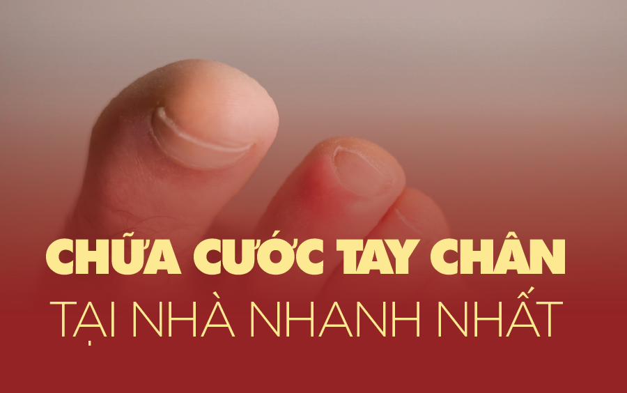 cước chân cước tay là gì