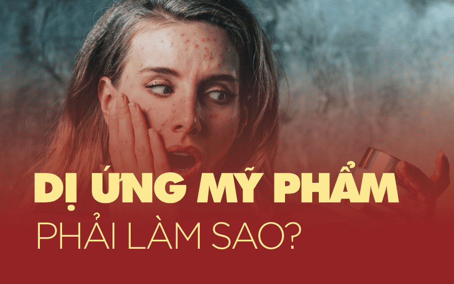 dị ứng mỹ phẩm