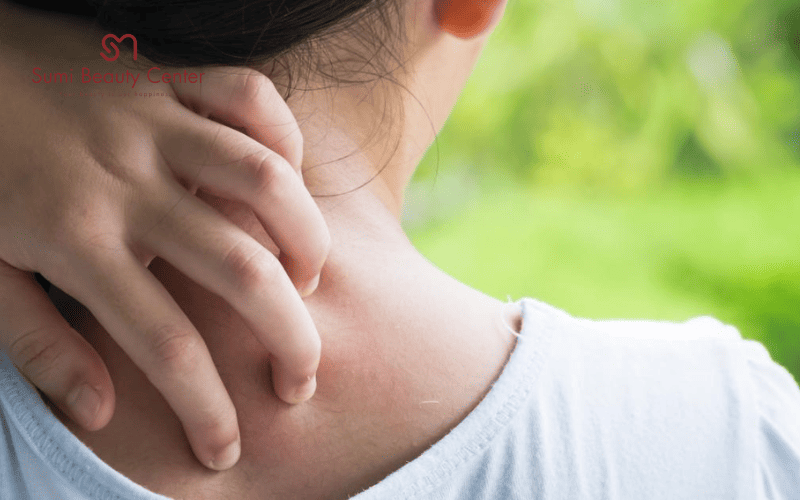 Dị ứng thời tiết lạnh là gì?