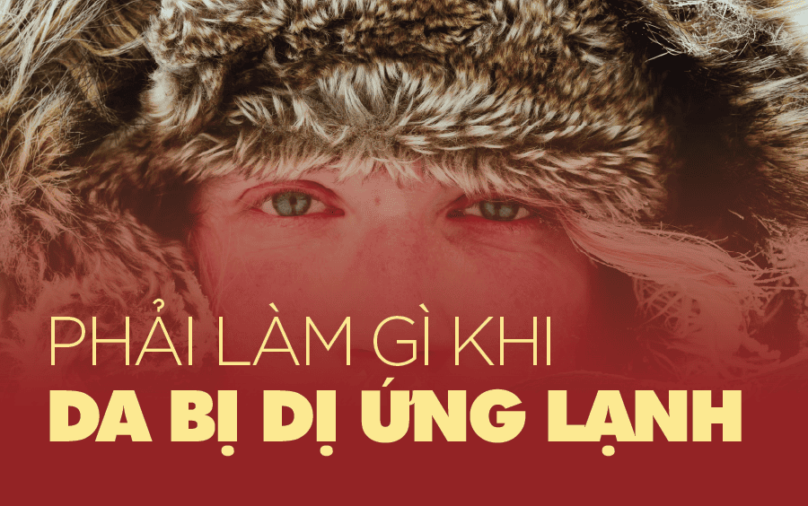 dị ứng thời tiết lạnh ngứa