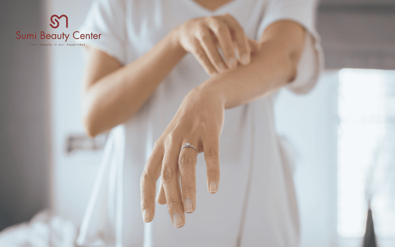 Nguyên nhân gây dị ứng lạnh