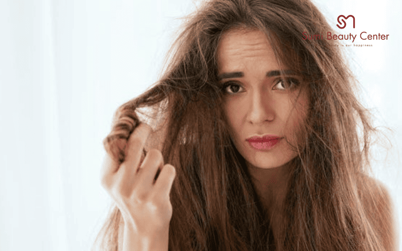 Những vấn đề tóc thường gặp trong mùa đông