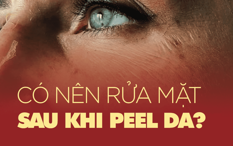 peel da bao lâu thì được rửa mặt