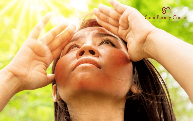 Tia UV vẫn tồn tại dù trời lạnh hay nhiều mây